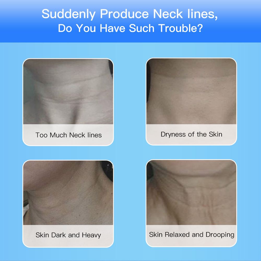 EMS Face & Neck Beauty Device - Image 6