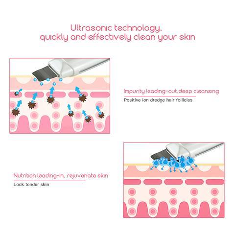 Ultrasonic Skin Scrubber Face Cleanser - Image 3